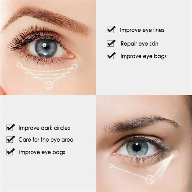 2024 Nicotinamide Eyes Cream Dark Circles Fading Eye Bags Eye Hyaluronic Acid Moisturizing Serum Against Puffiness Eye Care Gel