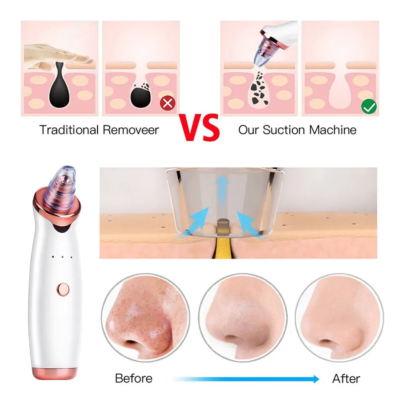 Blackhead Remover Face Deep Nose Cleaner T Zone Pore Acne Pimple Removal Vacuum Suction Facial Diamond Beauty Clean Skin Tool