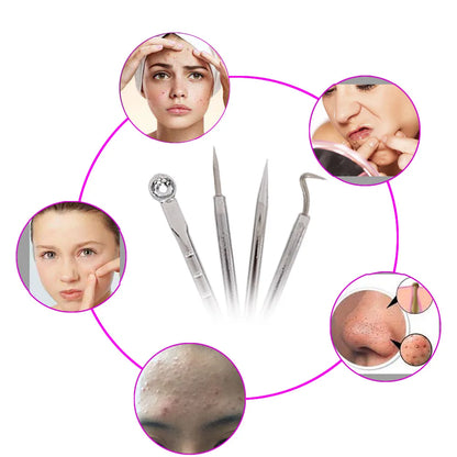 4PCS Acne Blackhead Comedone Black Spot Pimple Blemish Remover Skin Care Women Beauty Acne Treatment Pore Cleanser Needle Hook