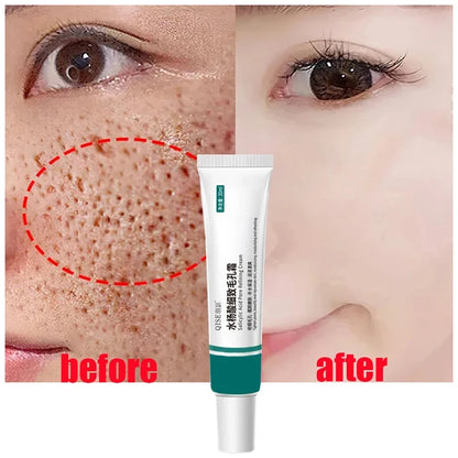 Salicylic Acid Pore Shrinking Cream Repairing Tightening Face Serum Moisturizing Oil Control Skin Care Korean Cosmetic 2024